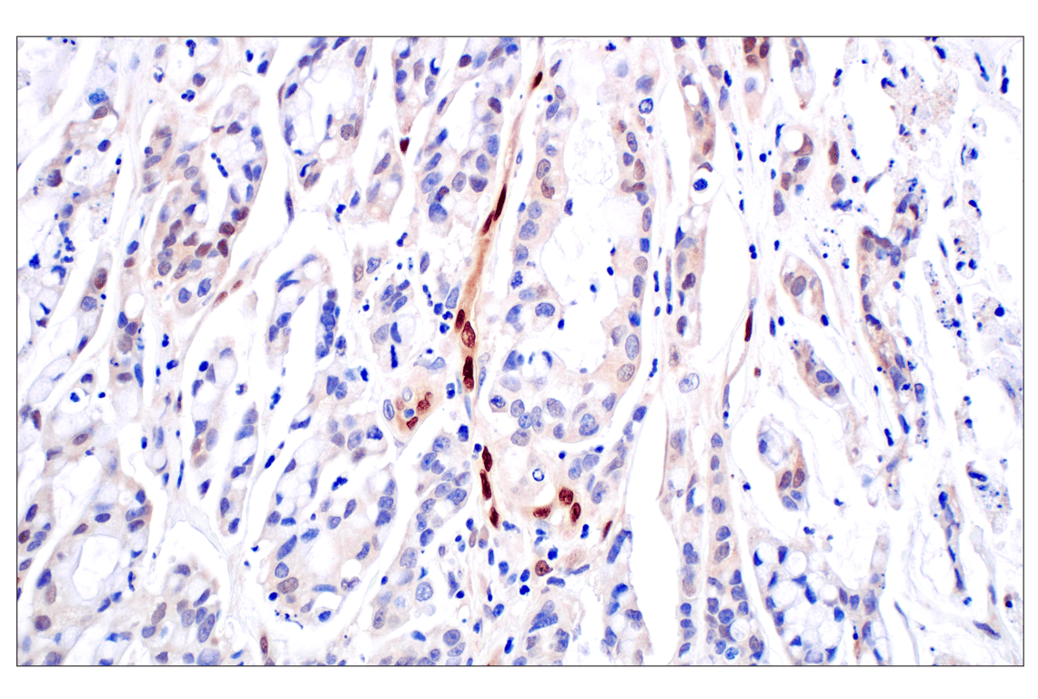 Immunohistochemistry Image 5: ID1 (F2M1J) Rabbit Monoclonal Antibody (BSA and Azide Free)
