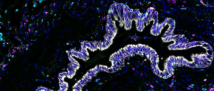 Fuel your next spatial breakthrough with a diverse, validated portfolio of low- to high-plex solutions. Compatible with a wide variety of platforms, samples, and workflows.