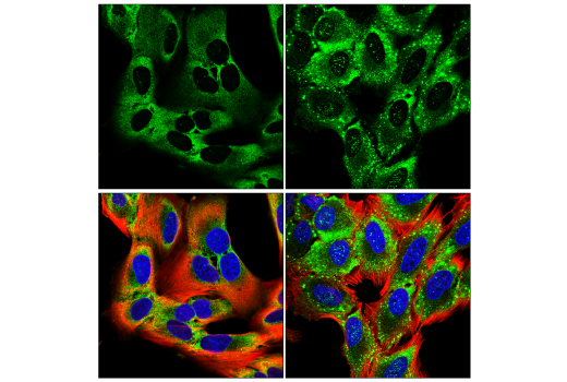 Immunofluorescence Image 2: YTHDF1 (E9P6V) Rabbit Monoclonal Antibody