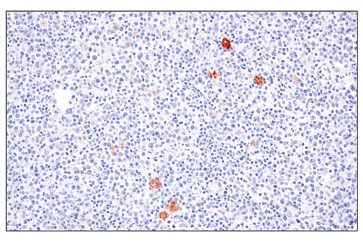 Immunohistochemistry Image 8: Occludin (E6B4R) Rabbit Monoclonal Antibody (BSA and Azide Free)
