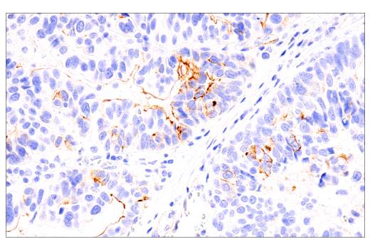Immunohistochemistry Image 4: DOG1/Anoctamin 1 (K9) Mouse Monoclonal Antibody
