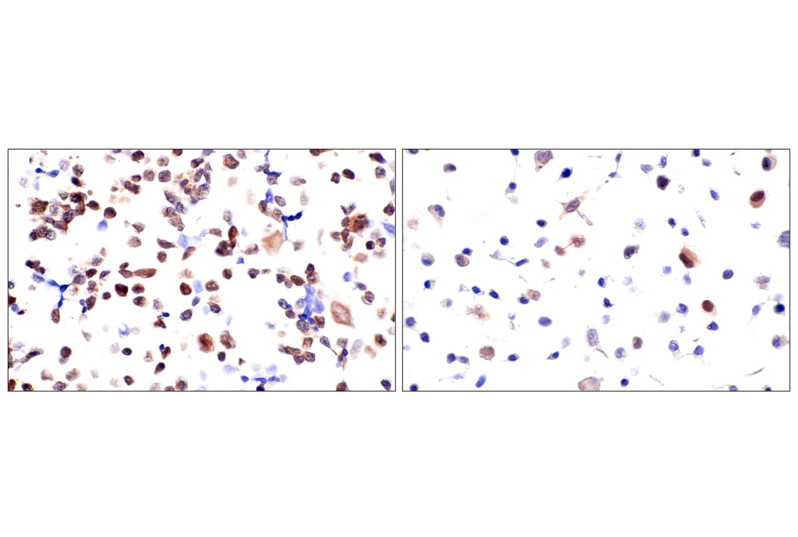 Immunohistochemistry Image 14: Chk1 (2G1D5) Mouse mAb