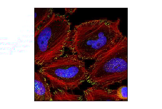 Immunofluorescence Image 1: Numb (C44B4) Rabbit Monoclonal Antibody
