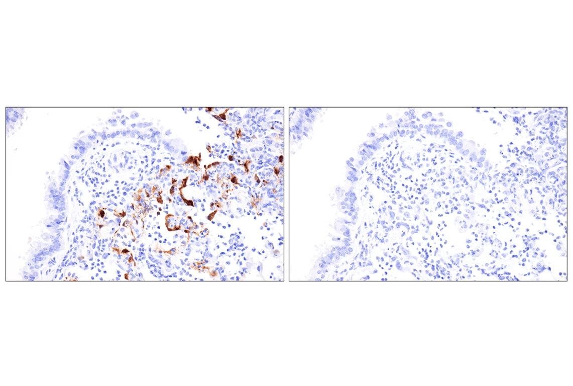 Nipah/Hendra virus Nucleocapsid (F5N9K) Rabbit Monoclonal Antibody