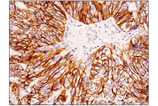 undefined Image 1: Catenin delta-1 (D7S2M) Rabbit Monoclonal Antibody