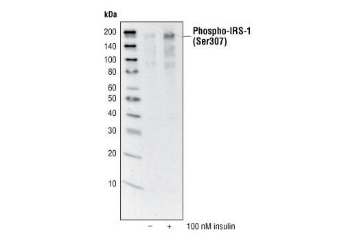 undefined Image 9: IRS-1 Inhibition Antibody Sampler Kit
