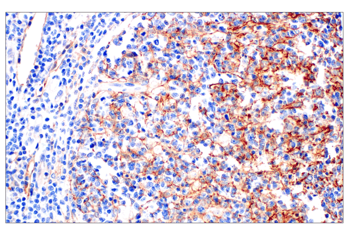 Immunohistochemistry Image 4: Neuropilin-2 (E5Q2G) Rabbit Monoclonal Antibody (BSA and Azide Free)