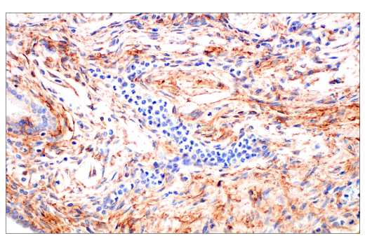 Immunohistochemistry Image 4: CD81 (D3N2D) Rabbit Monoclonal Antibody (BSA and Azide Free)