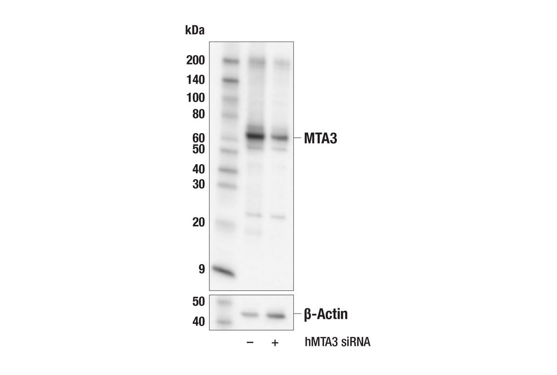 Western Blotting Image 2: MTA3 (E3X2E) Rabbit Monoclonal Antibody