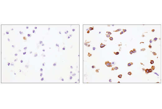 Immunohistochemistry Image 2: IFIT1 (D2X9Z) Rabbit Monoclonal Antibody