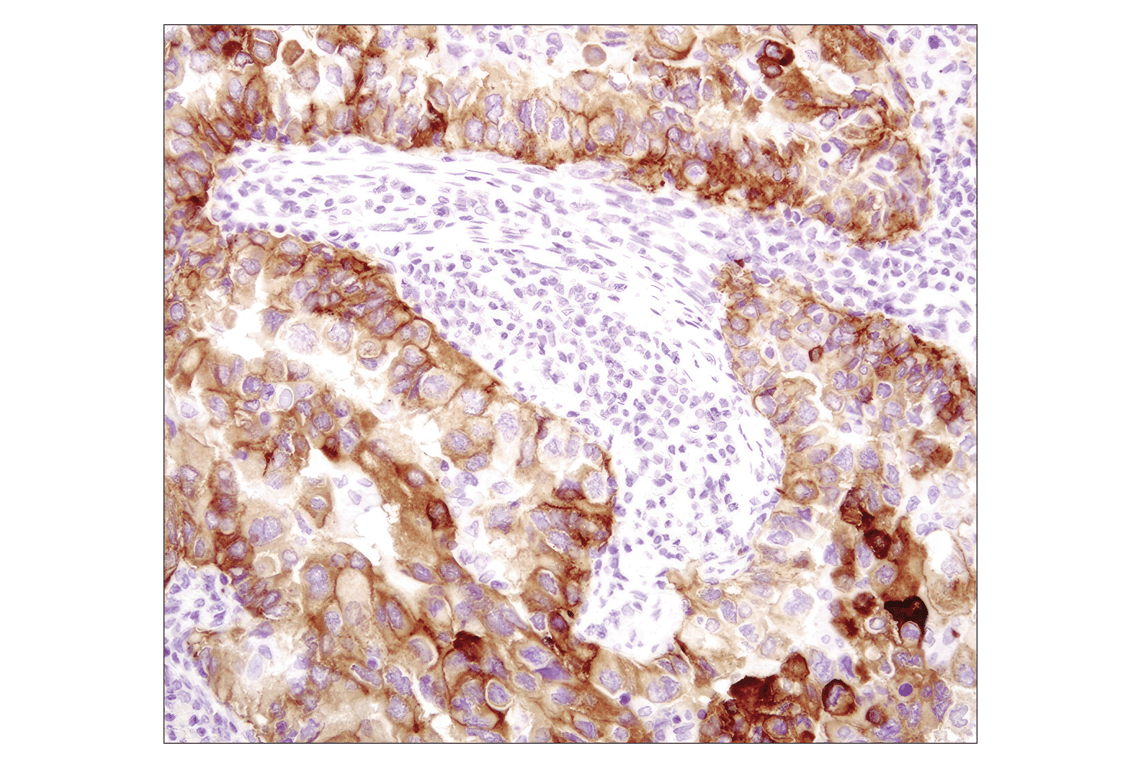 Immunohistochemistry Image 2: EGF Receptor (D38B1) Rabbit Monoclonal Antibody