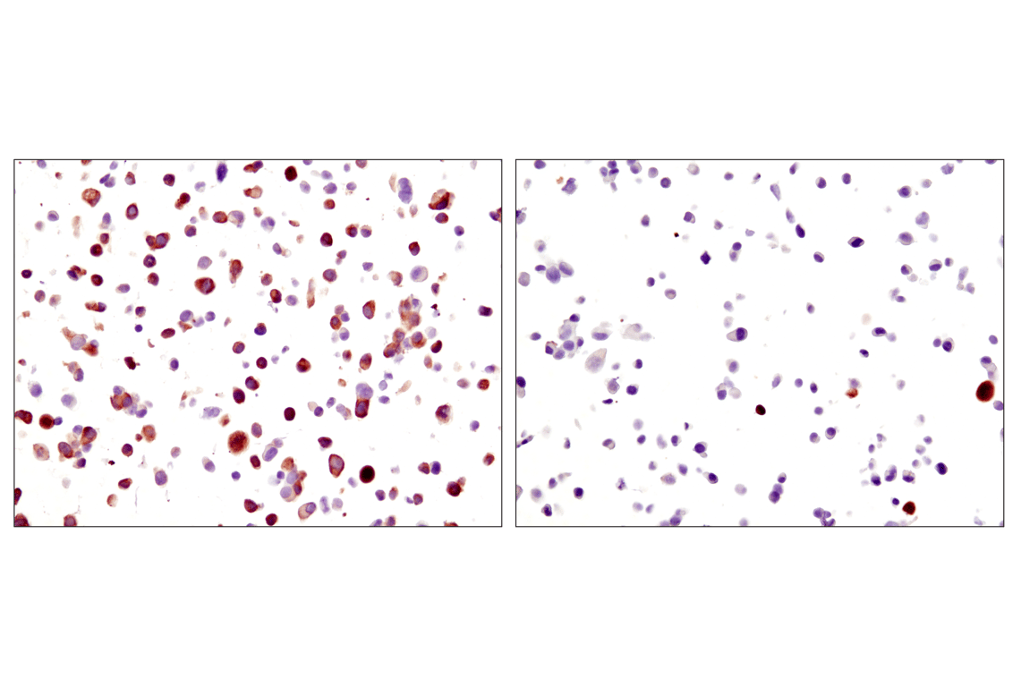 Immunohistochemistry Image 1: Phospho-S6 Ribosomal Protein (Ser235/236) (D57.2.2E) Rabbit Monoclonal Antibody (BSA and Azide Free)