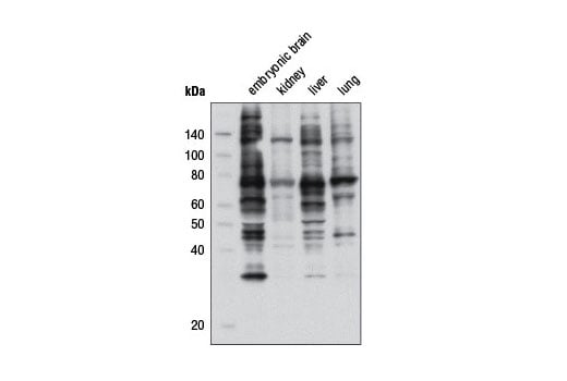 Western Blotting Image 2: Phospho-PKC Substrate Motif [(R/K)XpSX(R/K)] MultiMab<sup>®</sup> Rabbit Monoclonal Antibody mix