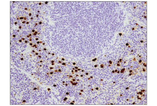 Immunohistochemistry Image 6: S100A9 (D3U8M) Rabbit Monoclonal Antibody (BSA and Azide Free)