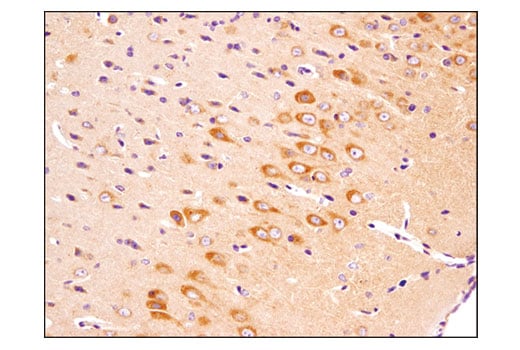 ma5ページ CD206/MRC1 (E6T5J) XP® Rabbit mAb (BSA and Azide Free