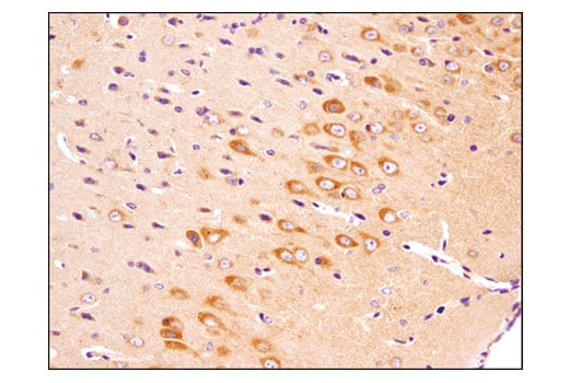 undefined Image 43: Cannabinoid Receptor 1 Downstream Signaling Antibody Sampler Kit