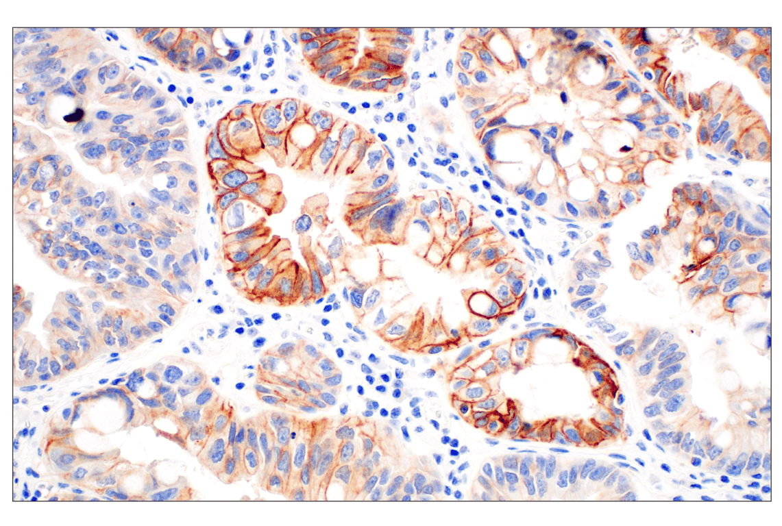 Immunohistochemistry Image 2: Integrin beta6 (E4M9P) Rabbit Monoclonal Antibody (BSA and Azide Free)