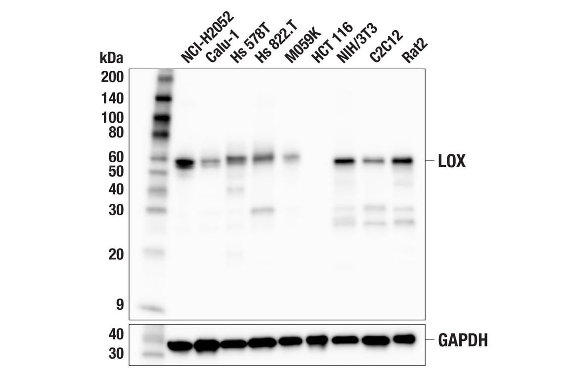 Western Blotting Image 2: LOX (F2C8F) Rabbit Monoclonal Antibody
