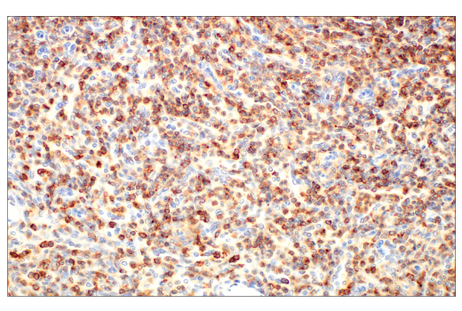 undefined Image 4: CD45 (Intracellular Domain) (D9M8I) Rabbit Monoclonal Antibody