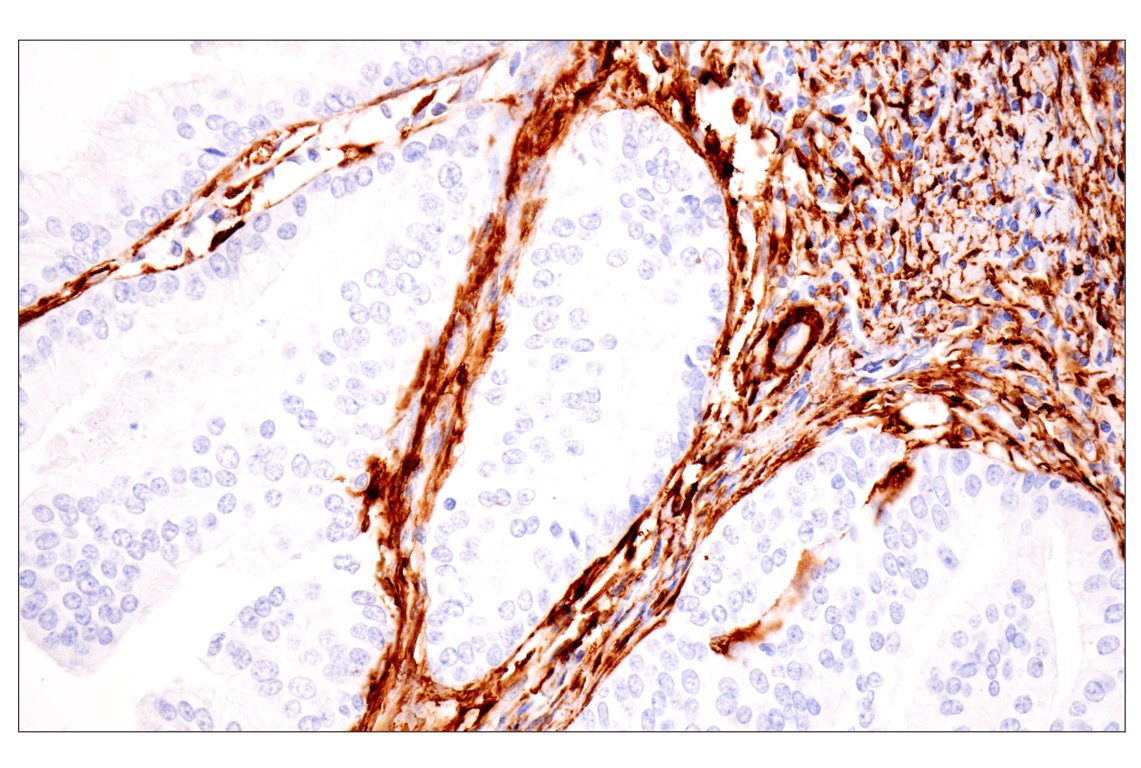 Immunohistochemistry Image 2: Transgelin/TAGLN (F3B7H) Rabbit Monoclonal Antibody