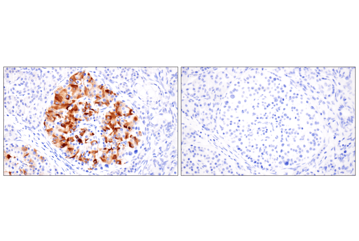 Immunohistochemistry Image 5: VGLUT2 (F1T6V) Rabbit Monoclonal Antibody