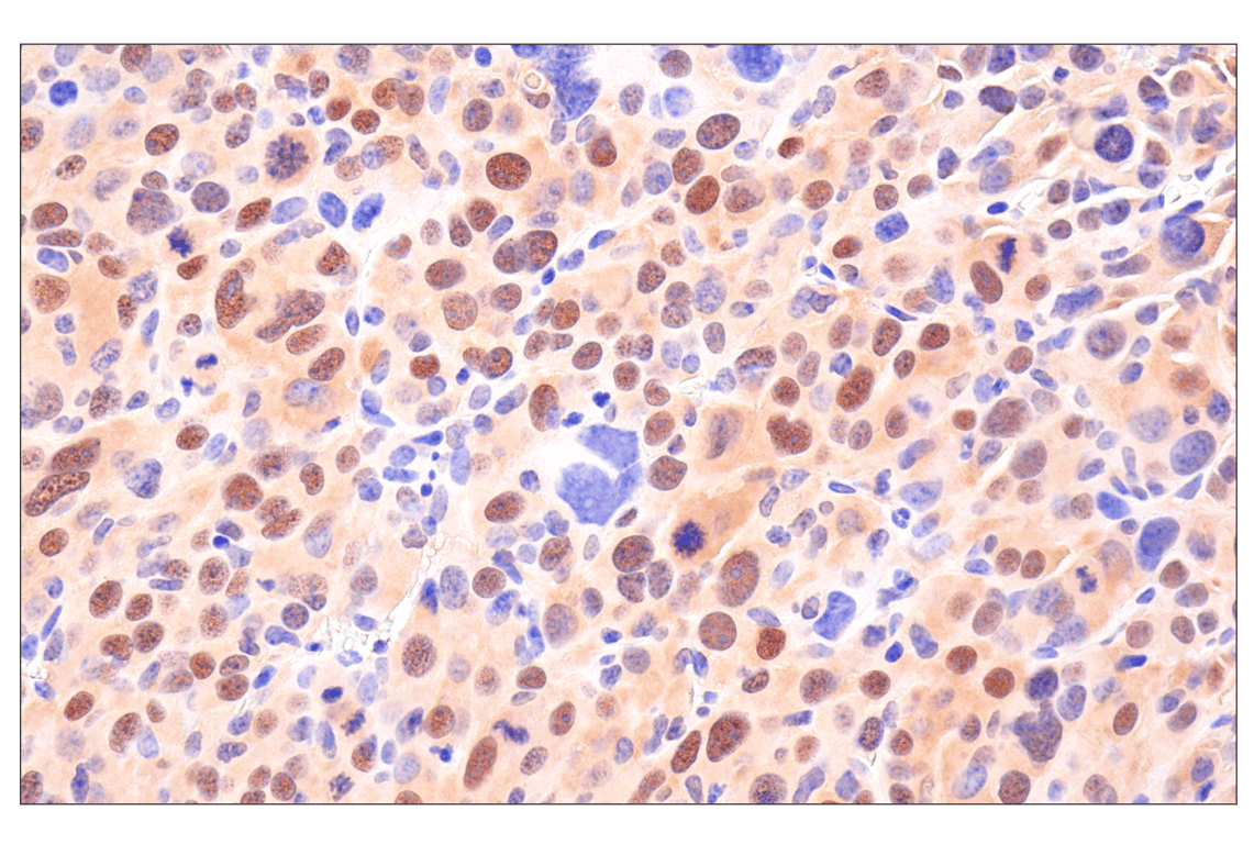 Immunohistochemistry Image 8: CDK6 (E3E3Q) Rabbit Monoclonal Antibody (BSA and Azide Free)