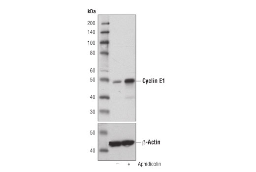 Western Blotting Image 2: Cyclin E1 (D7T3U) Rabbit Monoclonal Antibody