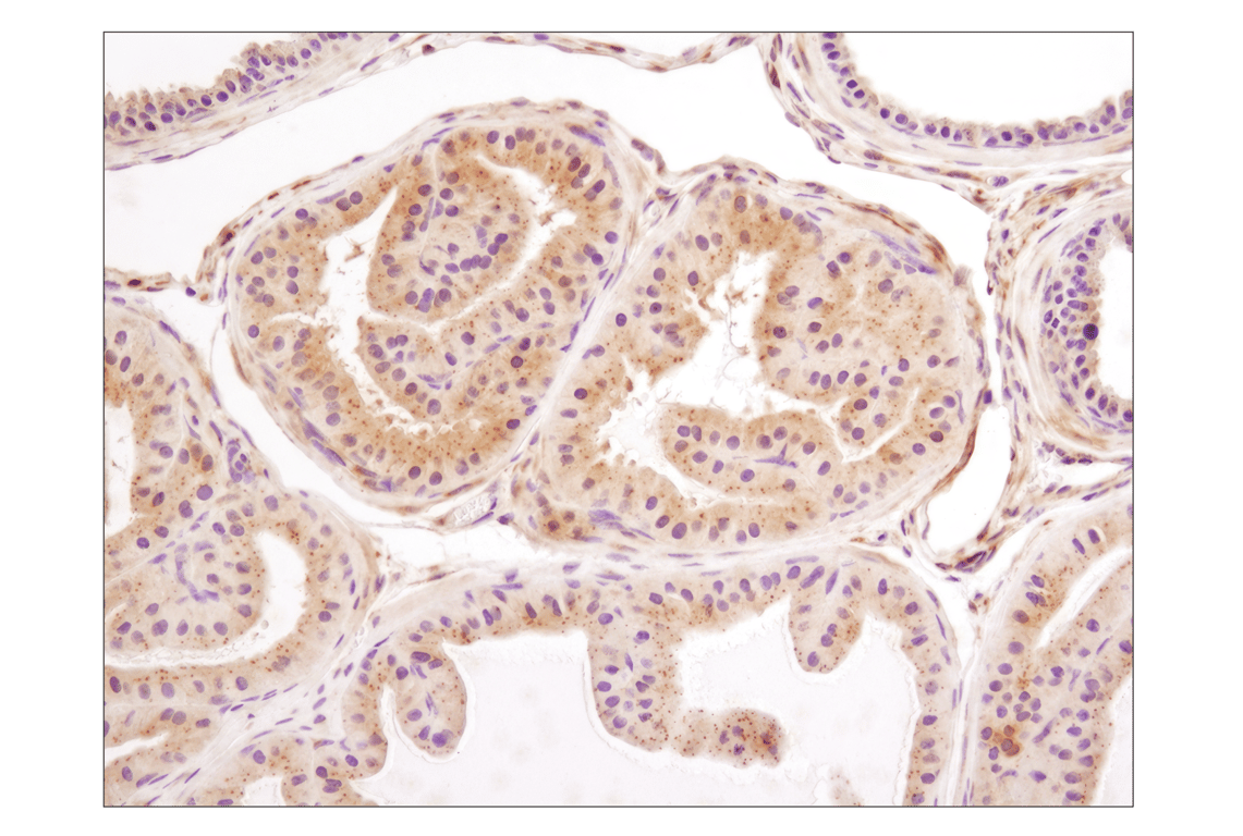 Immunohistochemistry Image 1: LC3A/B (D3U4C) XP<sup>®</sup> Rabbit mAb