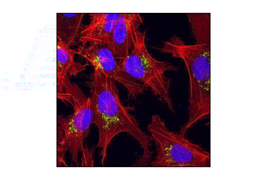 Immunofluorescence Image 1: AFP (3H8) Mouse mAb
