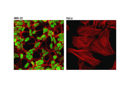 Immunofluorescence Image 1: N-Myc (D1V2A) Rabbit Monoclonal Antibody