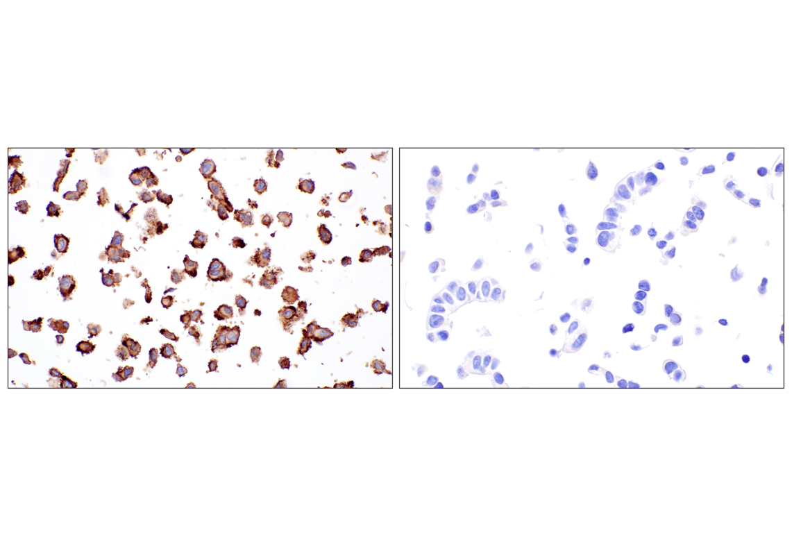 Immunohistochemistry Image 9: CD105/Endoglin (F9C5Q) Rabbit Monoclonal Antibody