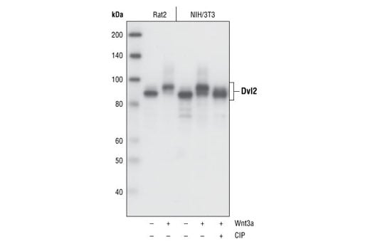 undefined Image 12: Wnt Signaling Antibody Sampler Kit