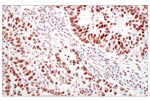 undefined Image 15: ATM Substrates Antibody Sampler Kit