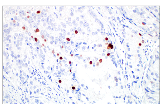 Immunohistochemistry Image 6: MAGE-C2/CT10 (E7B8D) Rabbit Monoclonal Antibody (BSA and Azide Free)