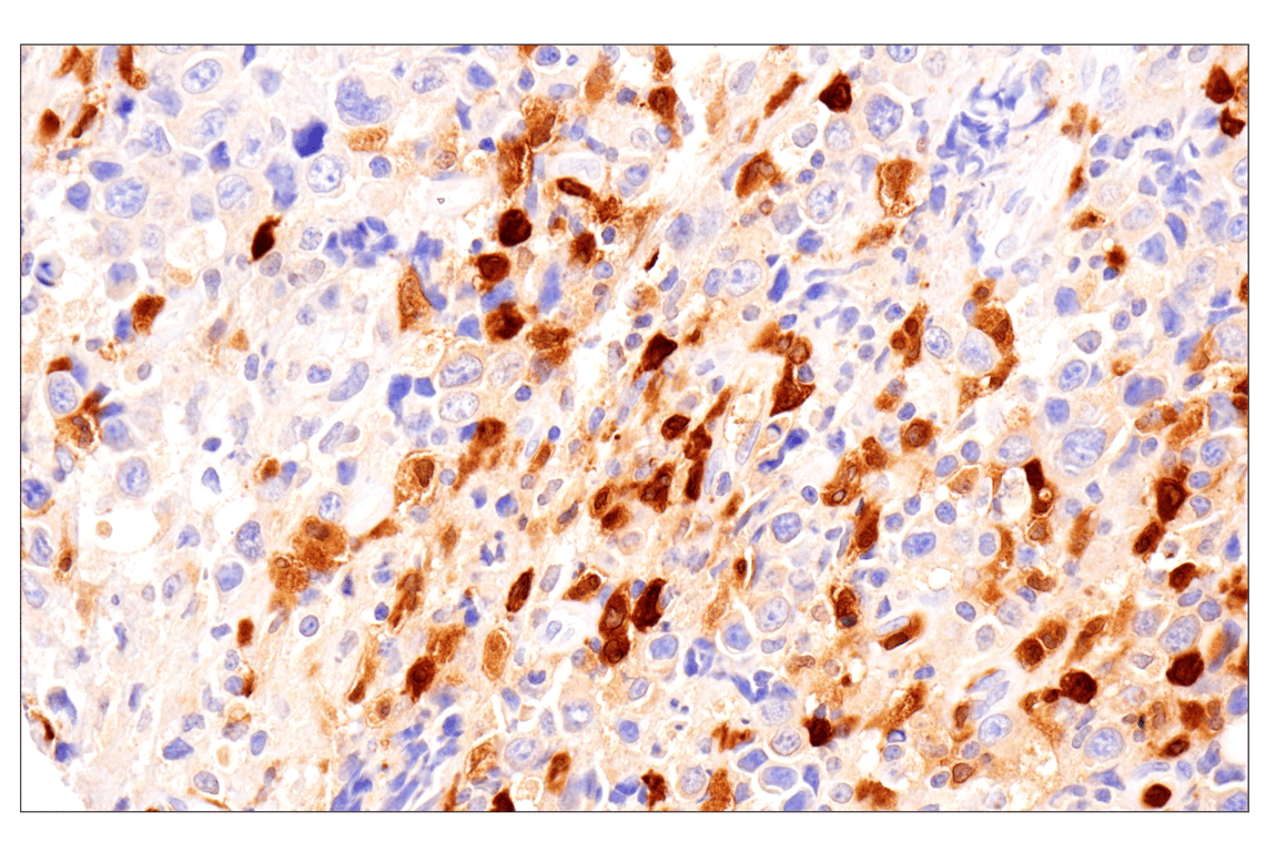 Immunohistochemistry Image 3: APOBEC3A (UMN-13) Rabbit Monoclonal Antibody (BSA and Azide Free)