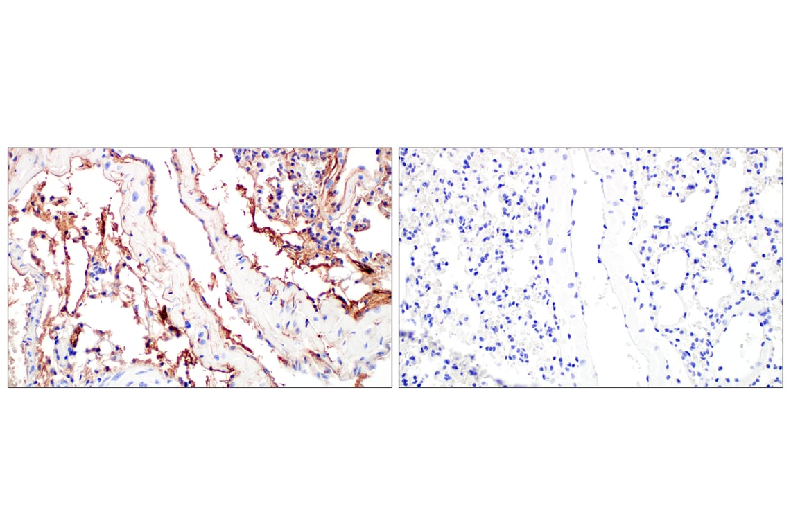 Immunohistochemistry Image 3: IgM (E8M1B) Rabbit Monoclonal Antibody (BSA and Azide Free)