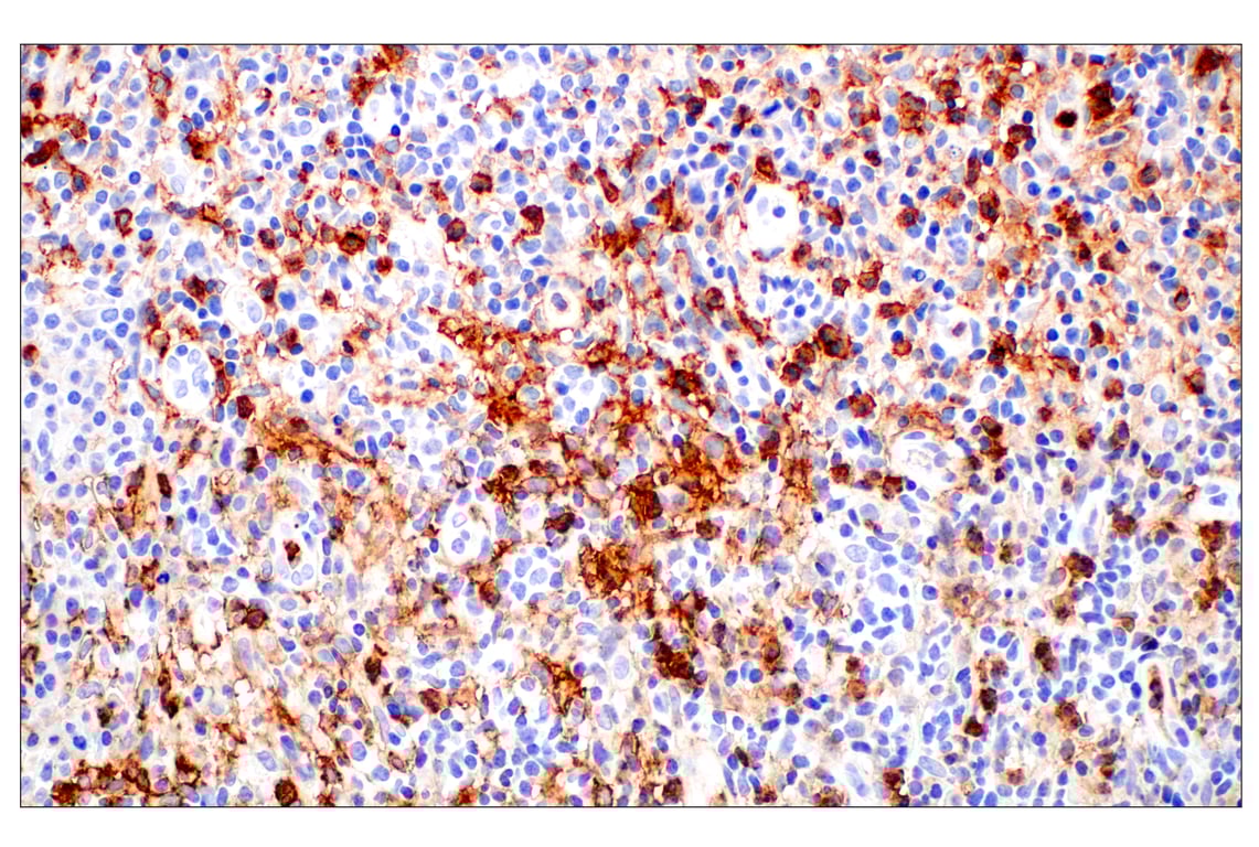 Immunohistochemistry Image 2: CD11b/ITGAM (E3J2F) Rabbit Monoclonal Antibody