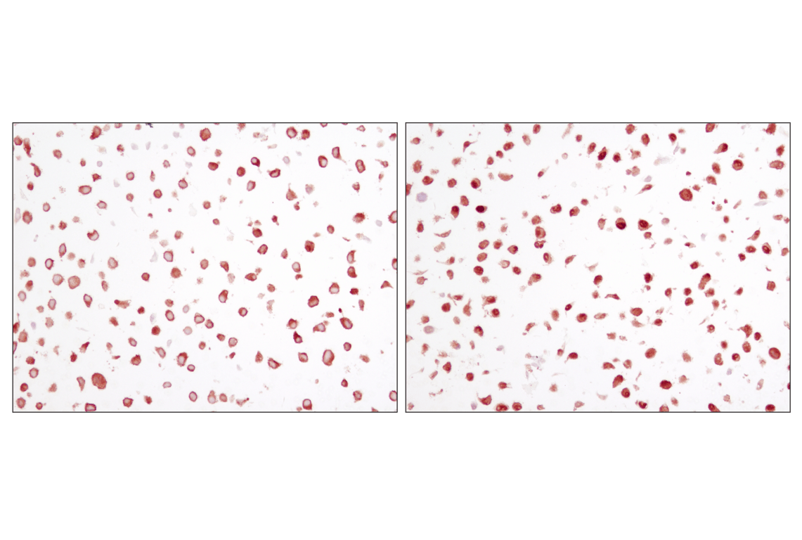 undefined Image 16: NF-kappaB p65 Antibody Sampler Kit