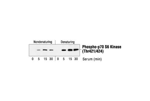 Immunoprecipitation Image 1: Phospho-p70 S6 Kinase (Thr421/Ser424) Antibody