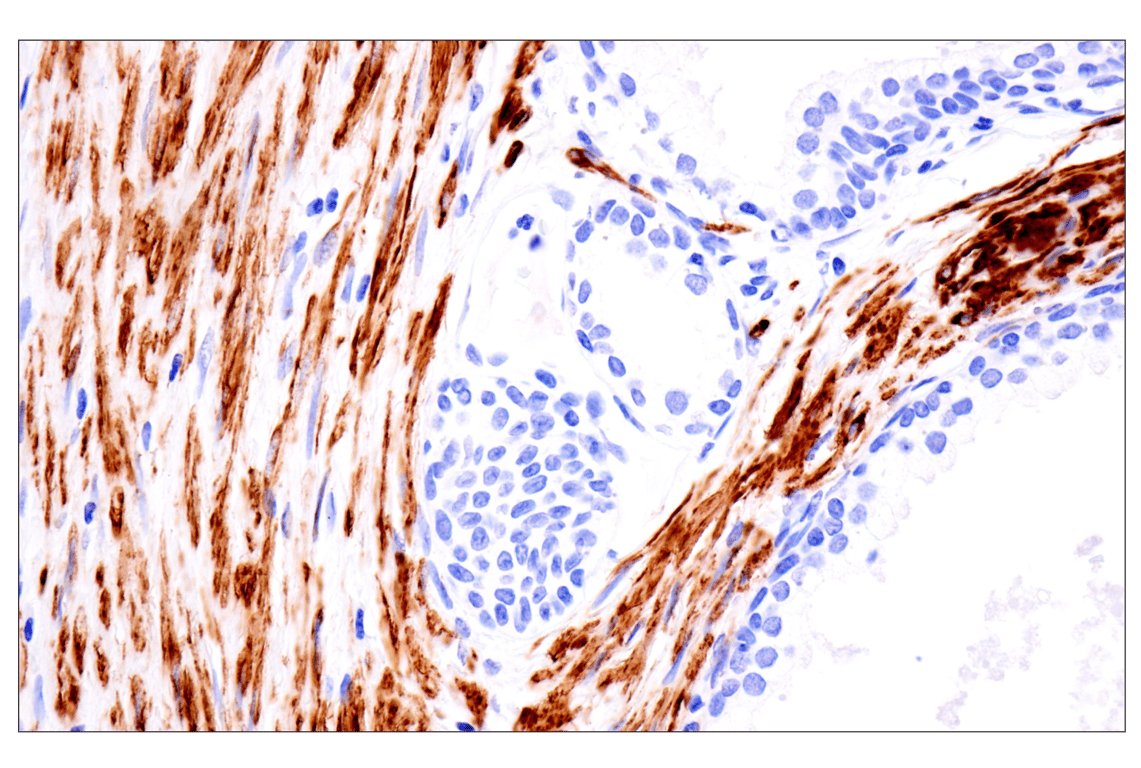 Immunohistochemistry Image 2: Desmin (F5V4I) Rabbit Monoclonal Antibody (BSA and Azide Free)