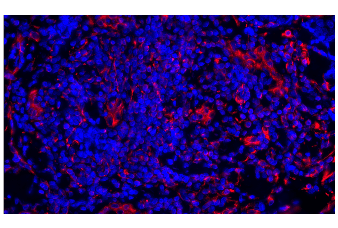 Vimentin (D21H3) XP® Rabbit mAb (Alexa Fluor® 555 Conjugate