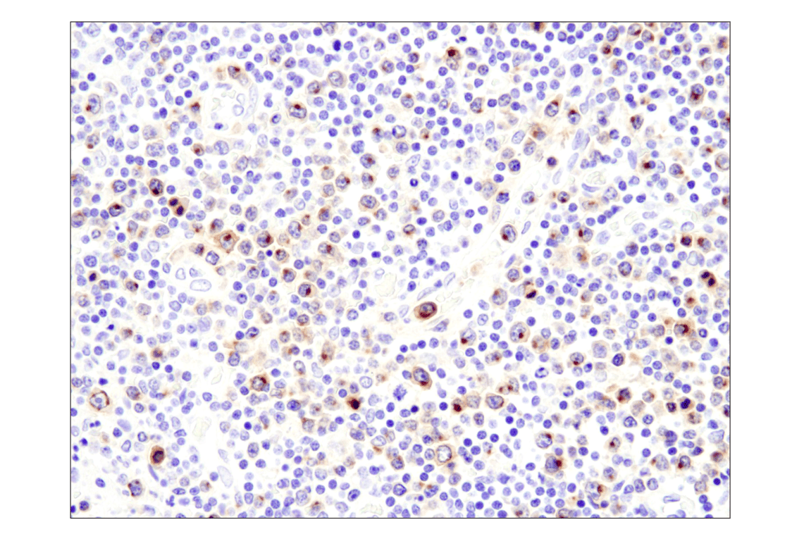 Immunohistochemistry Image 11: TNFRSF17/BCMA (E6D7B) Rabbit Monoclonal Antibody