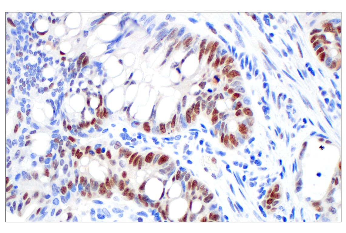 Immunohistochemistry Image 3: BRCA1 (E5S9G) Rabbit Monoclonal Antibody