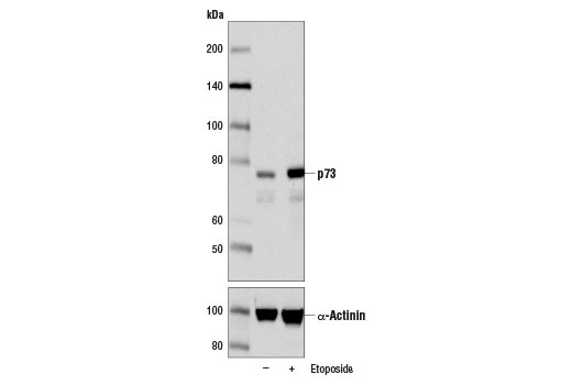 Western Blotting Image 2: p73 (D3G10) Rabbit Monoclonal Antibody