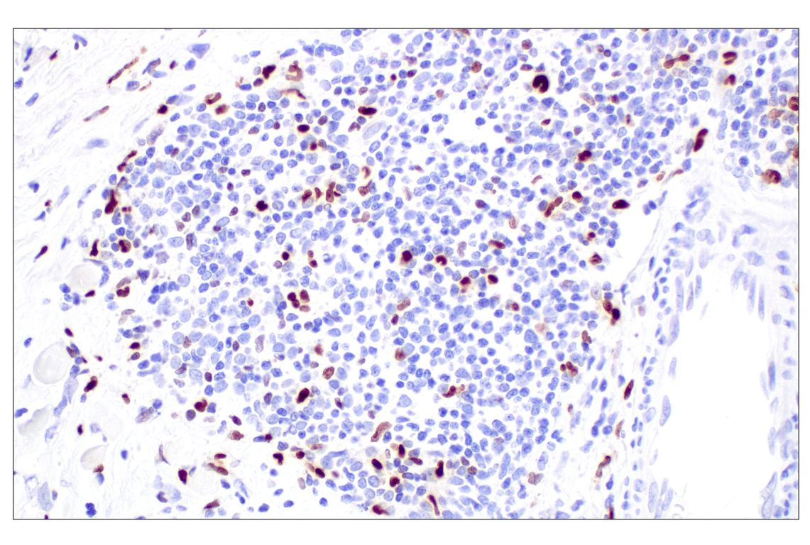 Immunohistochemistry Image 3: MNDA (3C1) Rat Monoclonal Antibody