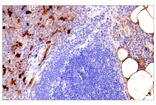 Immunohistochemistry Image 2: S100B (E7C3A) Rabbit Monoclonal Antibody (BSA and Azide Free)