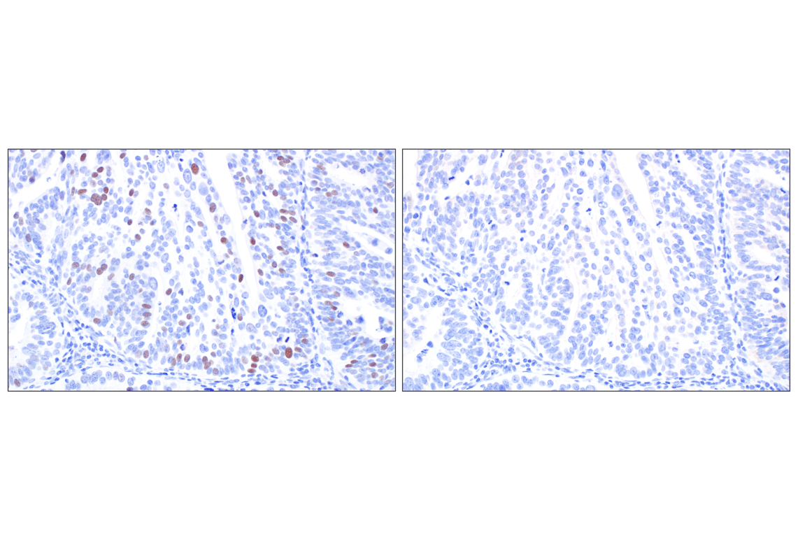 Immunohistochemistry Image 7: MASTL (F7I2C) Rabbit Monoclonal Antibody