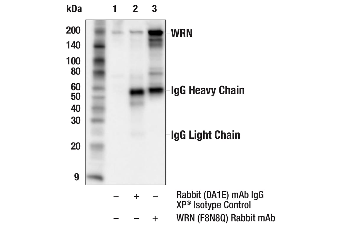 Immunoprecipitation Image 1: WRN (F8N8Q) Rabbit Monoclonal Antibody