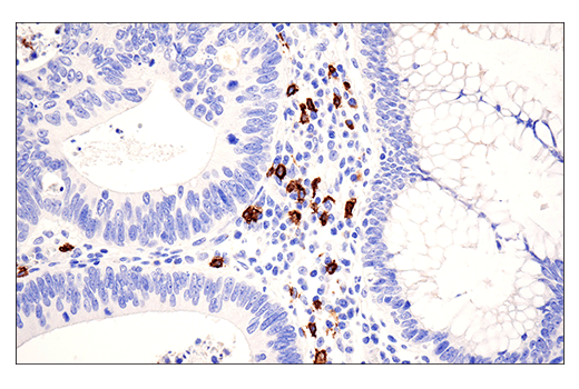 Immunohistochemistry Image 1: CD20 (E7B7T) Rabbit Monoclonal Antibody (BSA and Azide Free)