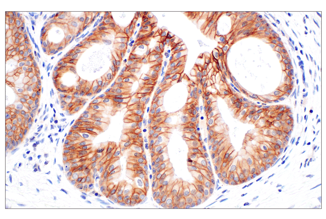 Immunohistochemistry Image 5: EpCAM (E6V8Y) Rabbit Monoclonal Antibody (BSA and Azide Free)